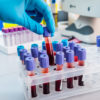 Blood Tests