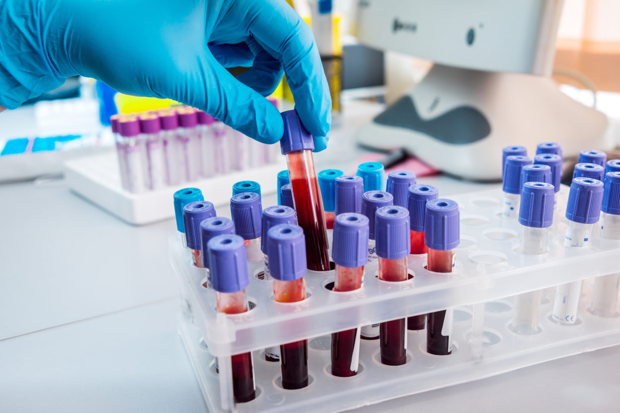 Blood Tests